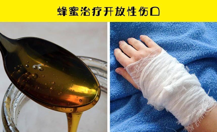 蜂蜜皮肤推荐苹果版:在家中也可以给自己处理新伤口的10种方法-第3张图片-太平洋在线下载